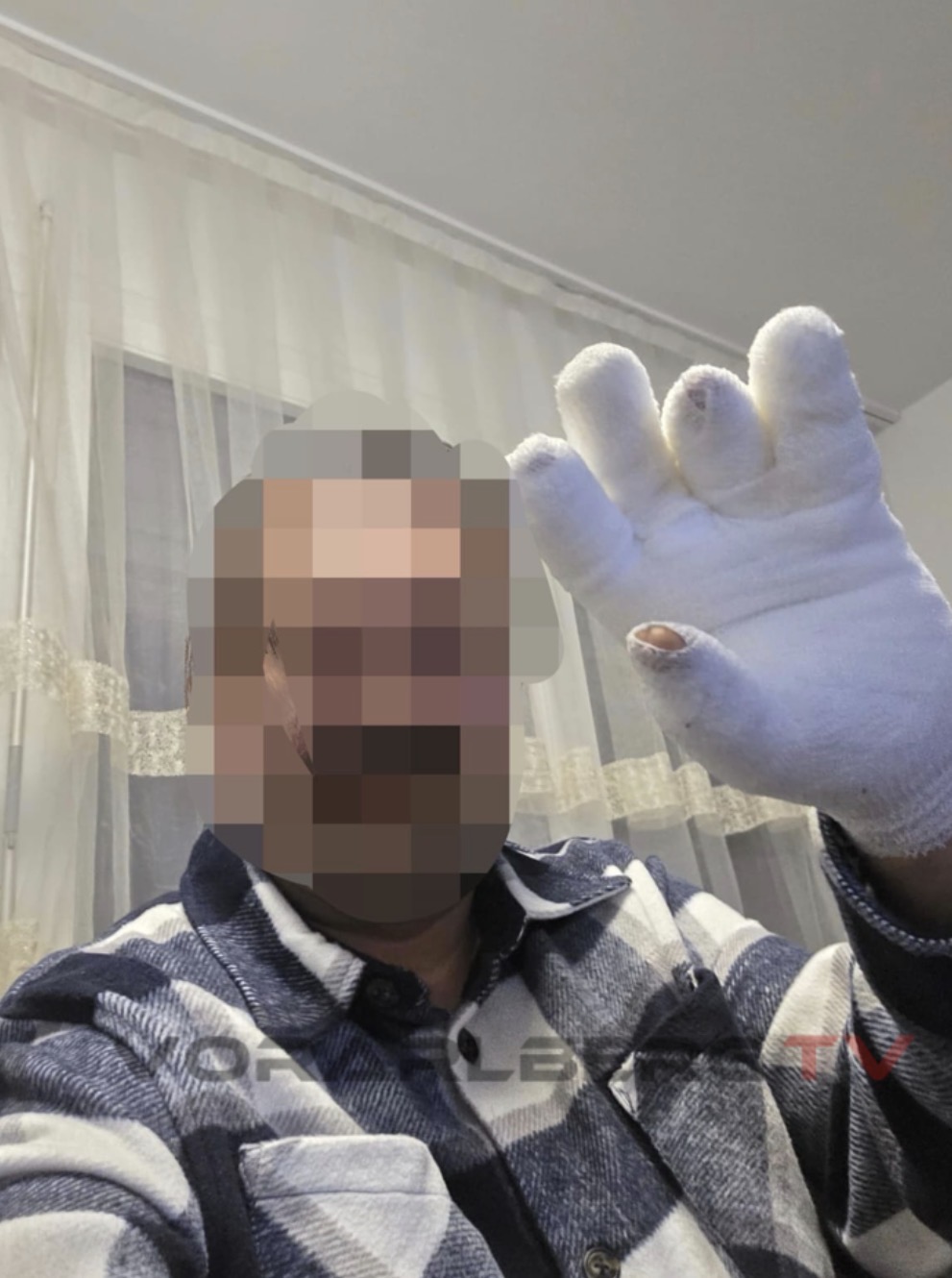 Yılbaşı Öncesi Havai Fişek Tehlikesi: Bir Anda Patladı, Vatandaş Yaralandı!